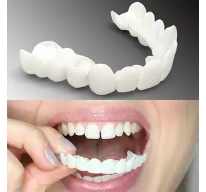 Знімні вініри для зубів Snap On Smile. Універсальні вініри на зуби